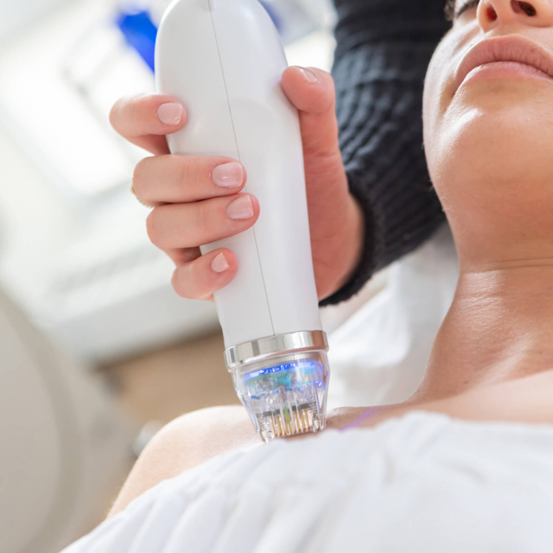 Microneedling Machines