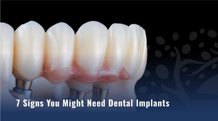 Top 5 Signs You Need Emergency Dental Help Now